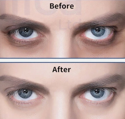 Caffeine Eye Serum for Eye Bags & Fine Lines